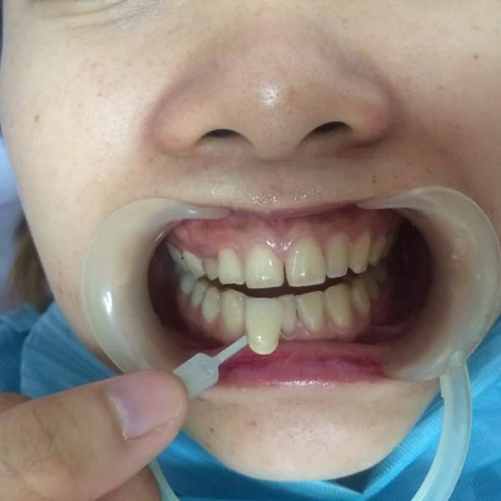Top 7 Địa chỉ Nha khoa uy tín nhất Đà Lạt, Lâm Đồng