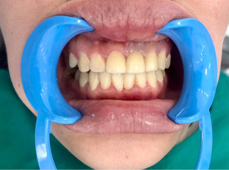 Top 7 Địa chỉ Nha khoa uy tín nhất Đà Lạt, Lâm Đồng