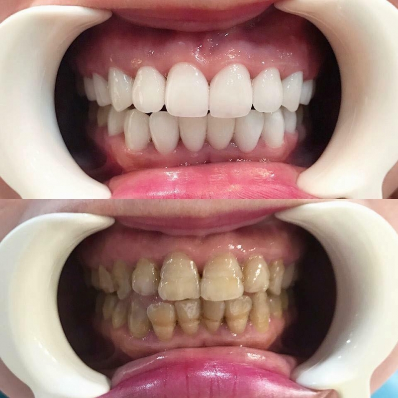 Top 7 Địa chỉ Nha khoa uy tín nhất Đà Lạt, Lâm Đồng