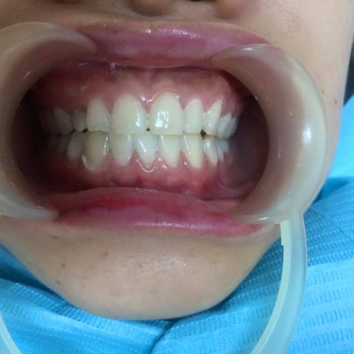 Top 7 Địa chỉ Nha khoa uy tín nhất Đà Lạt, Lâm Đồng