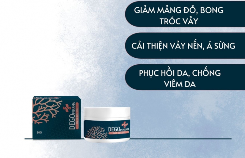 Kem bôi vẩy nến hương duy