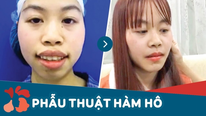 Bệnh Viện Thẩm Mỹ Kangnam