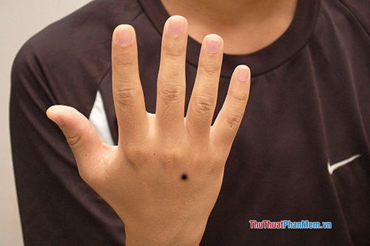 Ý nghĩa của nốt ruồi trên mu bàn tay là gì? Tích cực hay tiêu cực? Có nên xóa không?