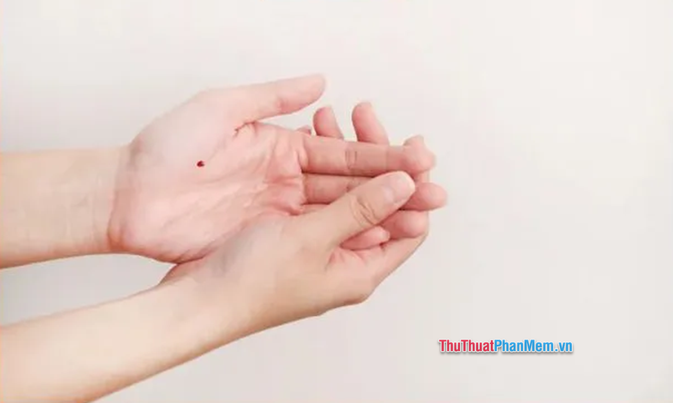 Bí mật của nốt ruồi son trong lòng bàn tay: Tốt hay xấu?