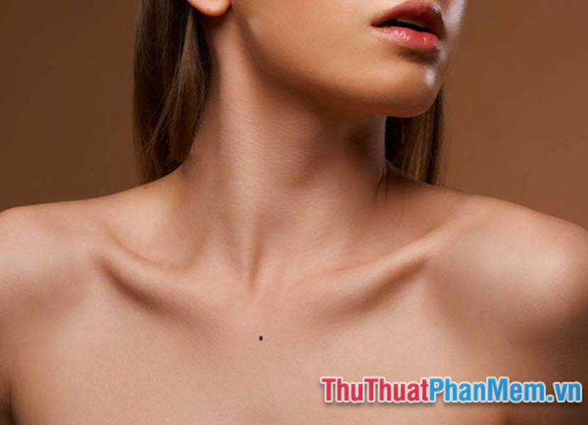 Nốt ruồi ở vùng trên ngực gần cổ và yết hầu
