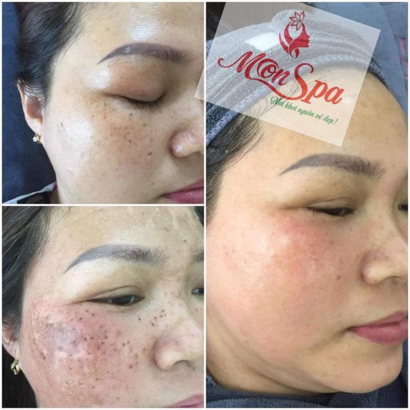 Top 10 Effective Skin Clinics for Dark Spot Removal in Hoan Kiem