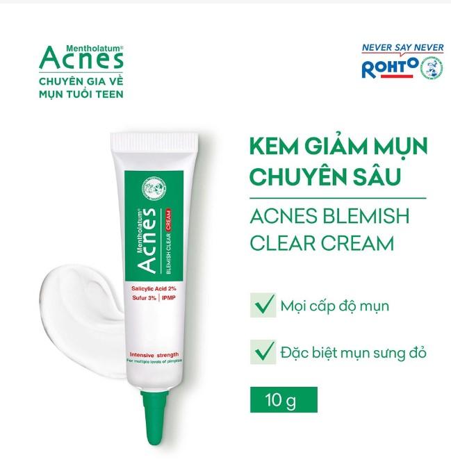 Top 10 Best Anti-Inflammatory Acne Creams - Mytour.vn