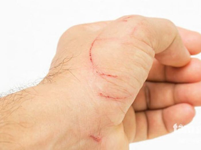 Images of Lightly Scratched Hands