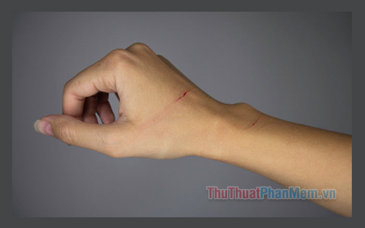 Images of Lightly Scratched Hands