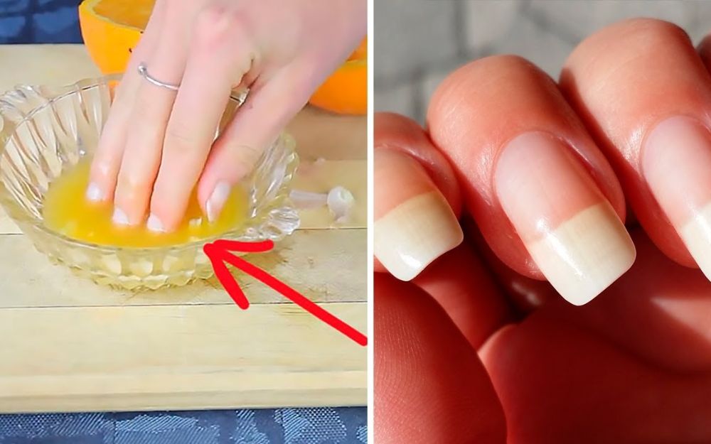 QuickCheck: Does sunlight help our nails grow faster?