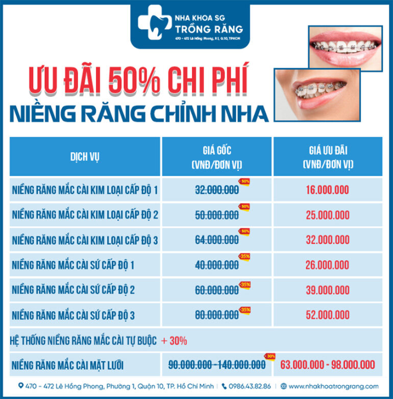 Thông tin về giá niềng răng
