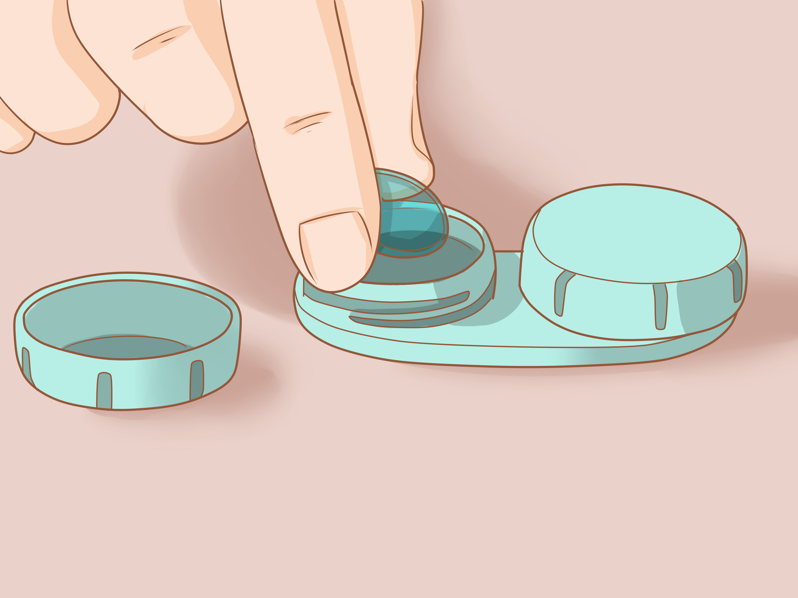 How To Insert And Remove A Scleral Lens A Visual Guide