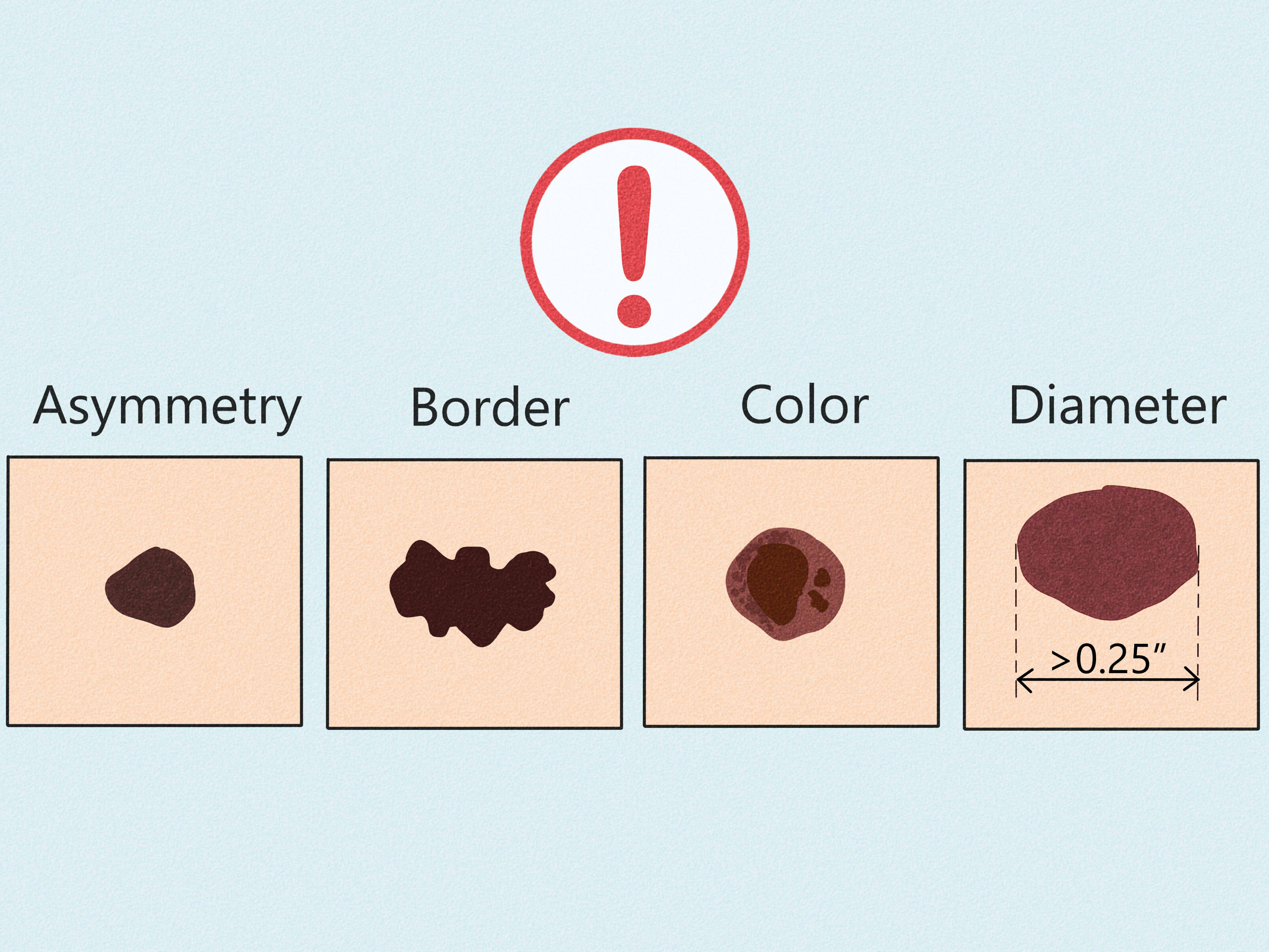 Understanding the Significance of Hand Moles: Interpretation ...