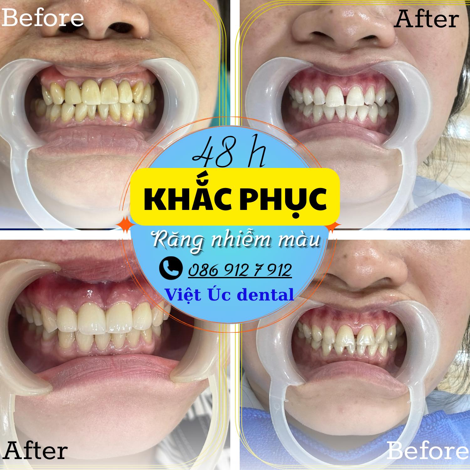 Khám phá và trải nghiệm dịch vụ chăm sóc răng miệng tại https//78win.dental/