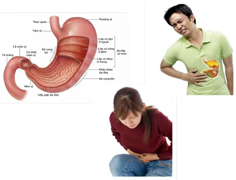 Top 10 Foods That Effectively Treat Stomach Antrum Inflammation - Mytour.vn