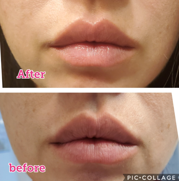 The reviewer's lips appear coarse initially but transform to a noticeably softer texture afterward
