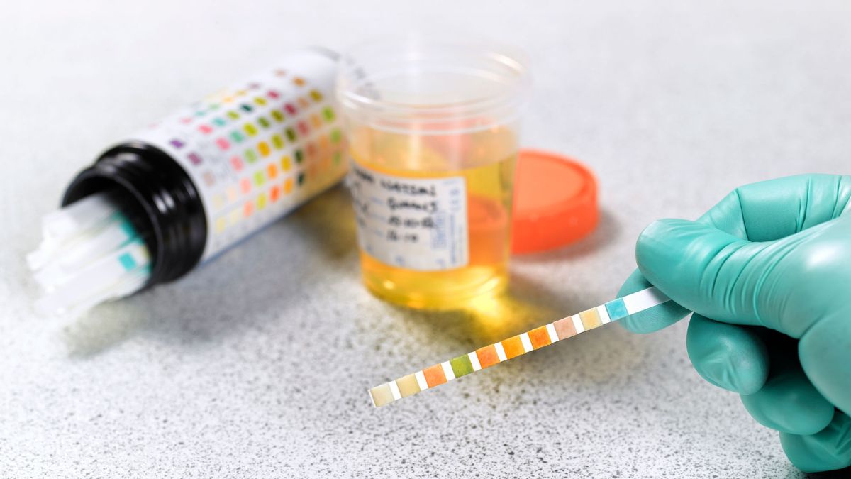 How To Use Someone Else's Pee For A Drug Test Is It Possible to Pass a Drug Test Using Another Person's Urine? | Mytour